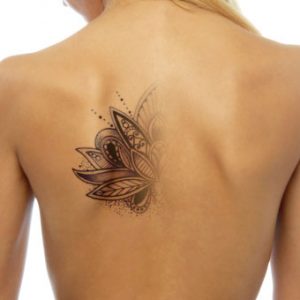 Curso Laser Remoção de Tatuagem